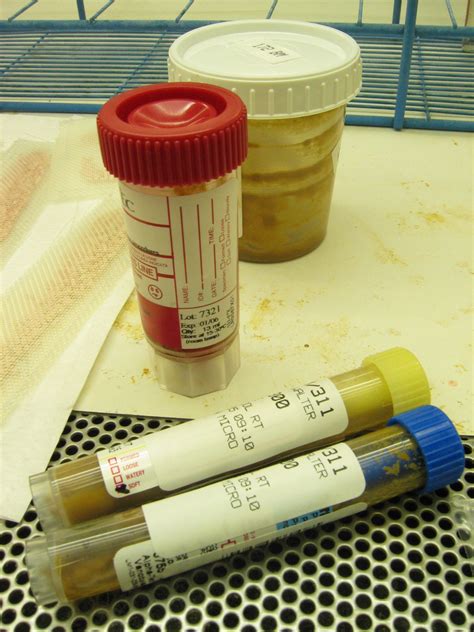 Stool test .